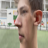 MR_corallo